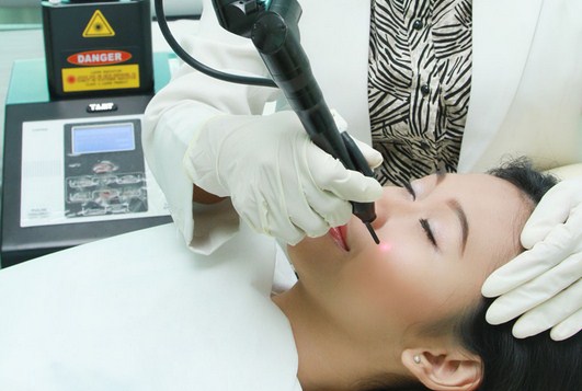 Harga Facial Perawatan di Natasha - Laser CO2